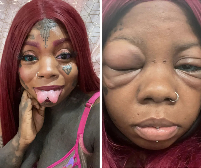 The Jamaican is used to body modifications, such as tongue splitting and tattoos, and shares her health status through TikTok