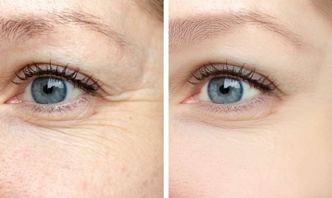 How to avoid wrinkles and other problems around the eyes?