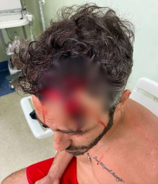 Imagem divulgada por O Globo mostra ator Thiago Rodrigues ferido após assalto