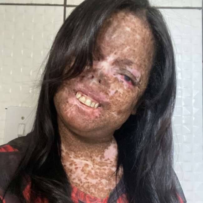 Juliana says she needs to have surgeries every three months and take biopsies to see if the tumor is malignant Juliana says she needs to have surgeries every three months and take biopsies to see if the tumor is malignant