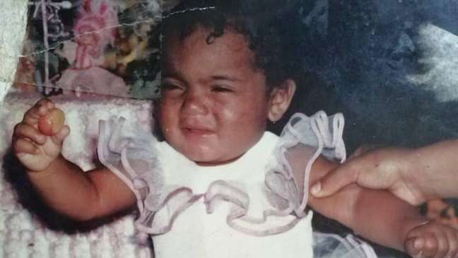 The signs of xeroderma pigmentosum began to appear when Juliana was two years old. The signs of xeroderma pigmentosum began to appear when Juliana was two years old.