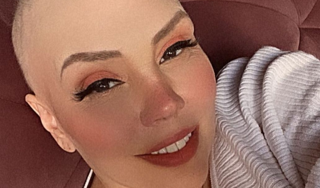 Simony celebrates end of bowel cancer treatment: ‘Very happy’