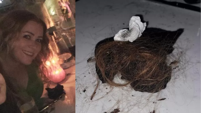 A woman’s hair catches fire while having dinner with friends