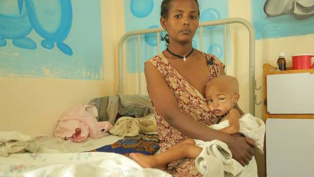 Esta é a segunda vez que Makda é hospitalizada com desnutrição