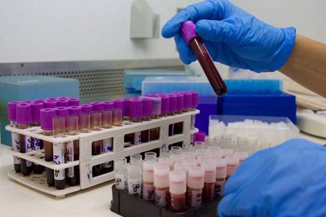 Alzheimer’s: Japan authorizes marketing of blood tests to detect the disease