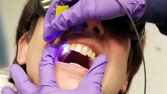 Dentists warn of risks of viral home treatments on TikTok