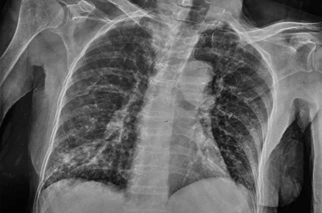 Bone fracture is one of the worst pains in the world (Image: liufuyu/envato) Bone fracture is one of the worst pains in the world (Image: liufuyu/envato)
