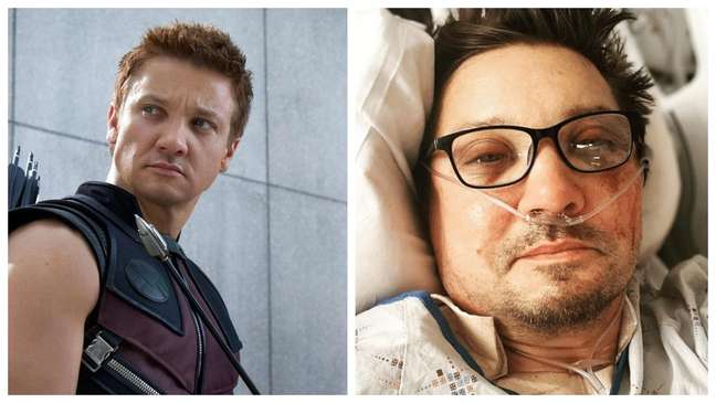 ‘He’s a fighter,’ says actor Jeremy Renner’s sister, Marvel’s ‘Hawkeye’ after crash