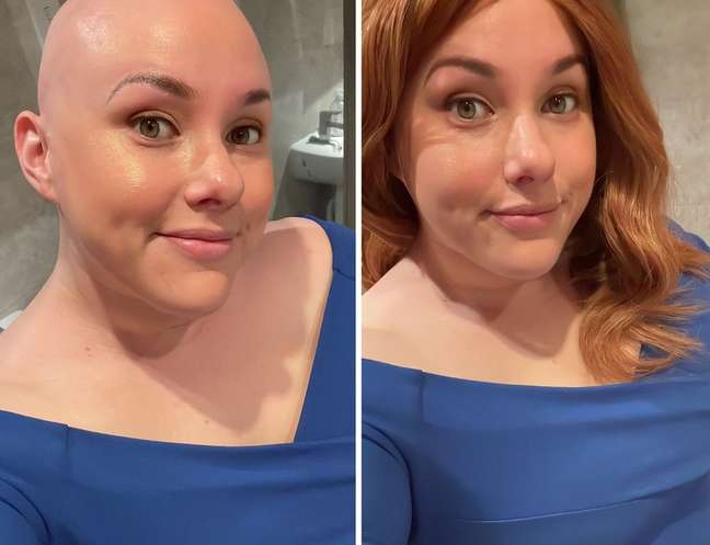 Laura still struggles to go to work without wearing a wig or headband. Laura still struggles to go to work without wearing a wig or headband.