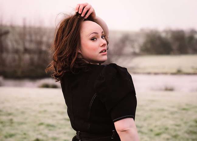 Alopecia: “I decided I could no longer hide who I really was”