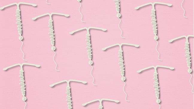 IUD: what it is, the types that exist and how the contraceptive method works