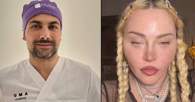 Madonna’s facial transformations, according to surgeon Umberto Tozzi