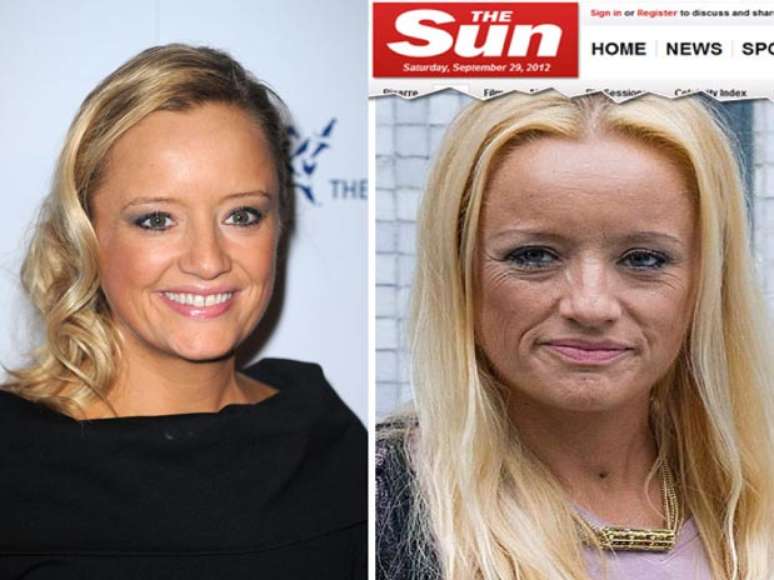 Aos 39 anos, a atriz est&aacute; em busca de terapias para melhorar seu quadro 