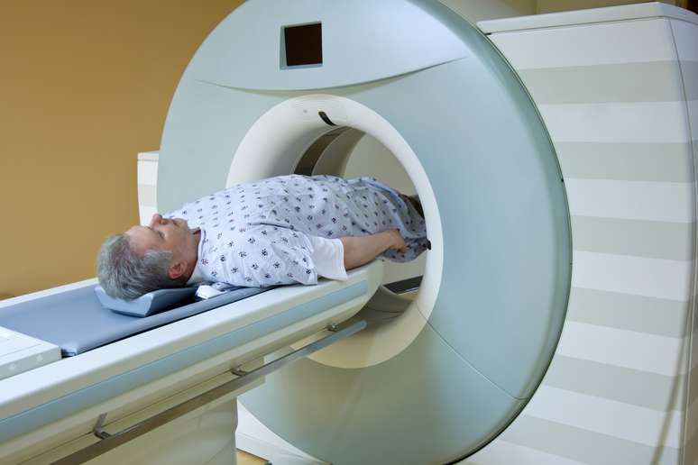 Segundo estudo, a radioterapia imediata diminui as chances de reincidência do câncer de próstata