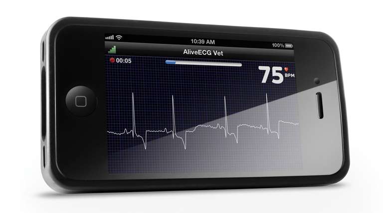 O AliveCor funciona como um eletrocardiograma portátil