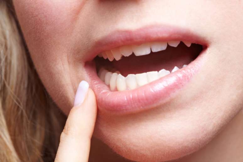 O dentista Hugo Roberto Lewgoy esclarece dúvidas sobre a saúde bucal