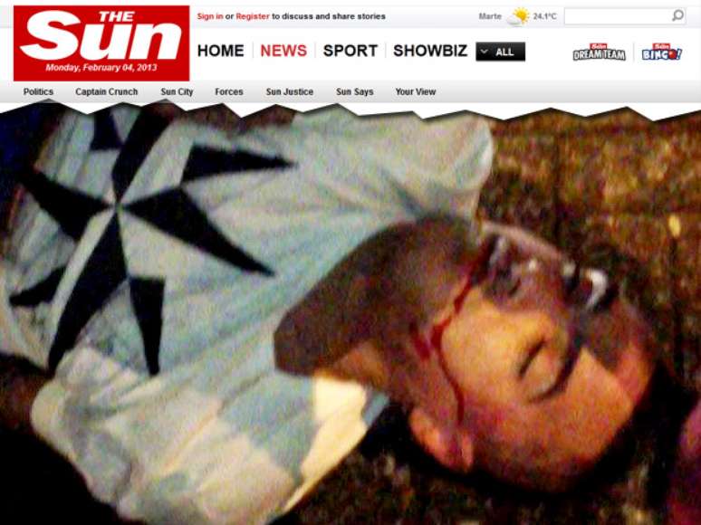 Foto mostra sangramento em rosto de Danny Simpson após briga de rua