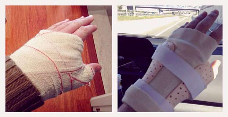 Casillas postou foto da bandagem na mão esquerda