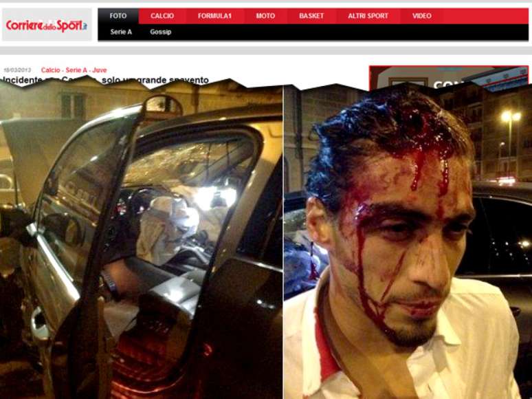 Imagem mostra rosto ensanguentado de Cáceres após acidente nas ruas de Turim