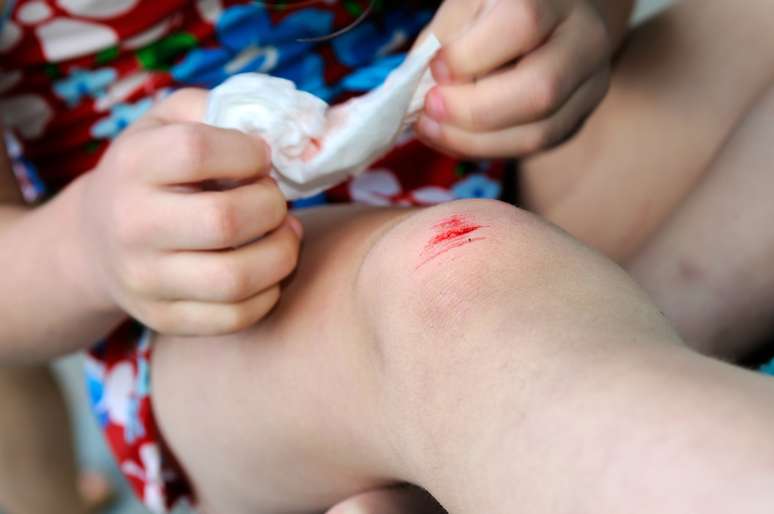 Pequenas lesões podem ser tratadas em casa com algum antisséptico