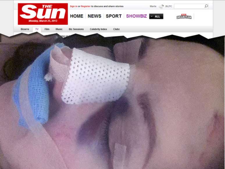 Imagem publicada pelo tabloide The Sun mostra Carol Vorderman durante cirurgia de emergência em Londres