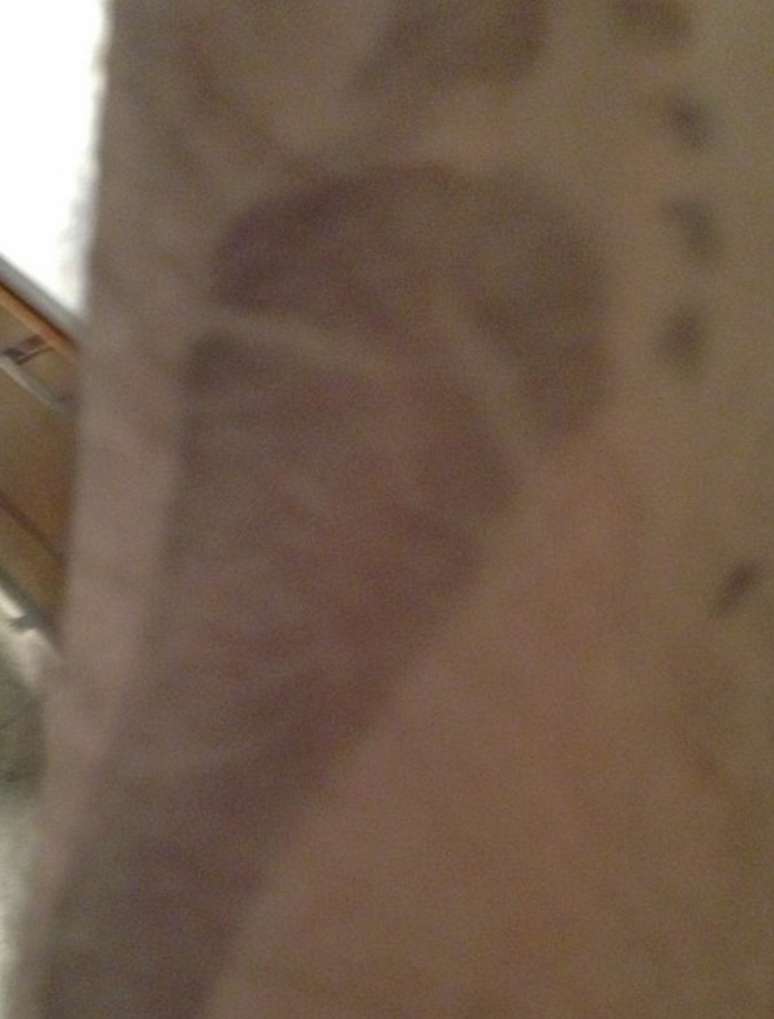 <p>O ex-nadador publicou uma foto do exame do pezinho da filha</p>