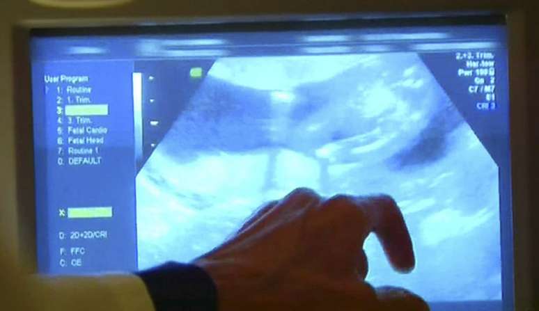 O trailer da oitava temporada de Keeping Uo with the Kardashians mostra o ultrassom de Kim