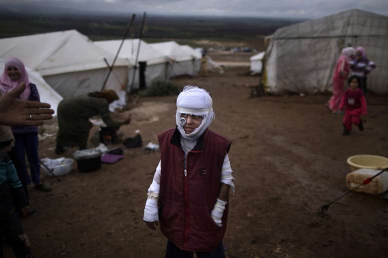 <p>Uma série de 20 fotos de cinco fotógrafos da agência AP recebeu o prêmio Pulitzer de Melhor Cobertura Gráfica Informativa com as imagens registradas na guerra civil na Síria. Na foto, uma das vencedoras, o menino Abdullah Ahmed, 10 anos, que sofreu queimaduras em um ataque aéreo do governo sírio</p>