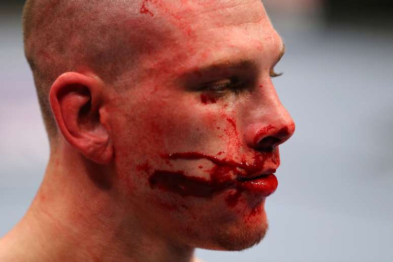 <p>Steven Siler fez Kurt Holobaugh sangrar bastante na primeira luta do card preliminar</p>