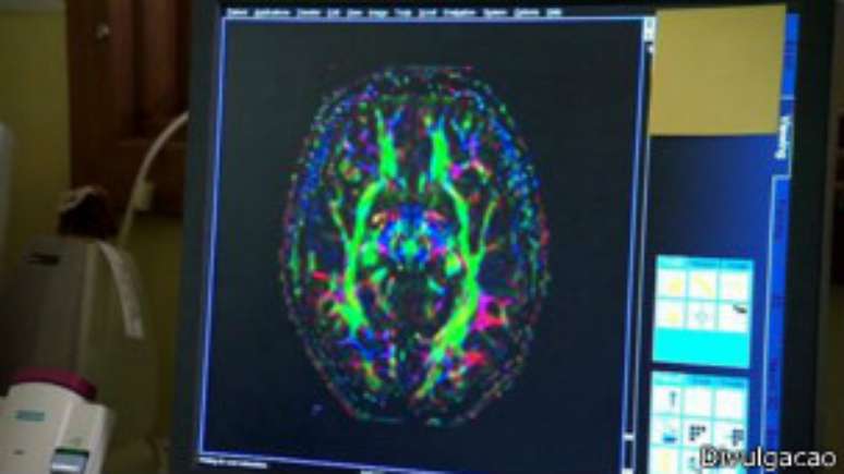 Os especialistas vão utilizar ressonância magnética para estudar o cérebro dos jovens