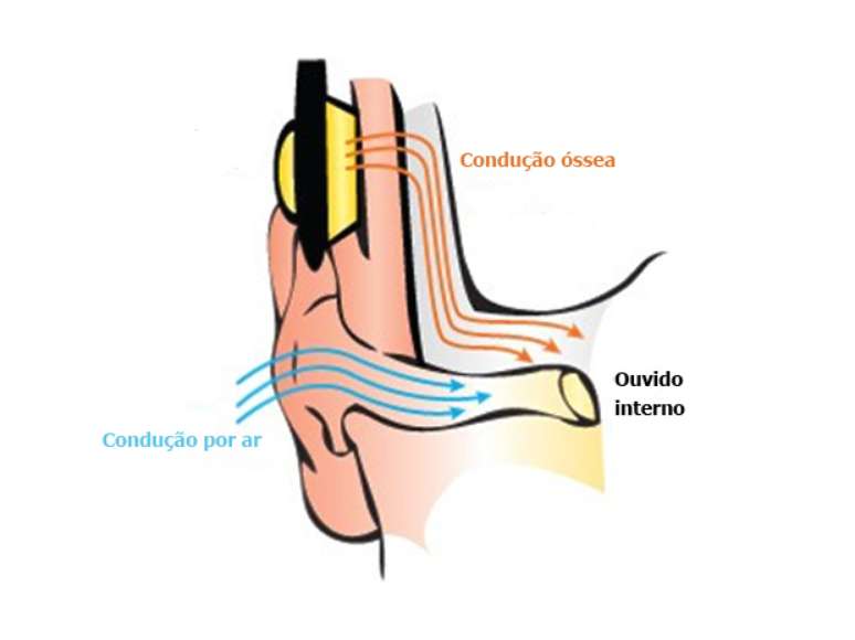 Em vez de usar o ar para transmitir vibrações à cóclea, fones da Finis usam osso da mandíbula