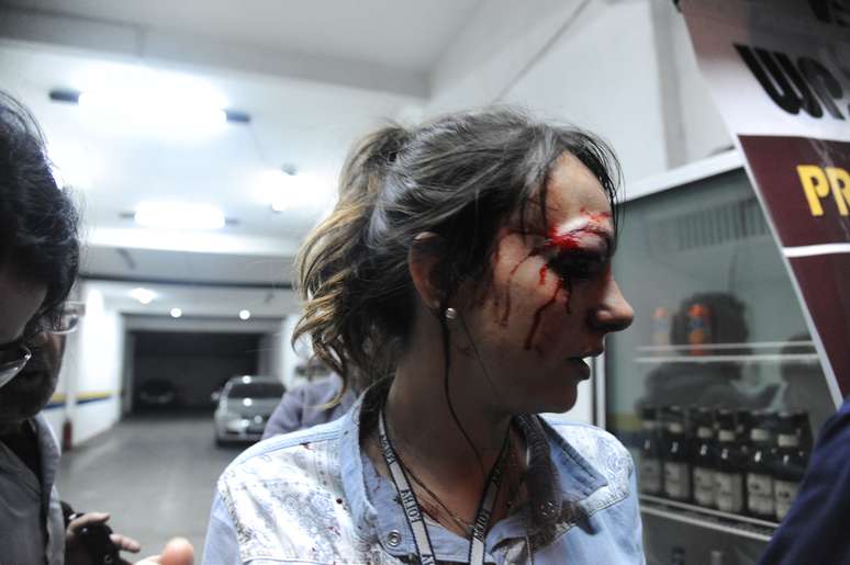 <p>A rep&oacute;rter Giuliana Vallone, do jornal Folha de S. Paulo, foi atingida no olho por uma bala de borracha da PM</p>
