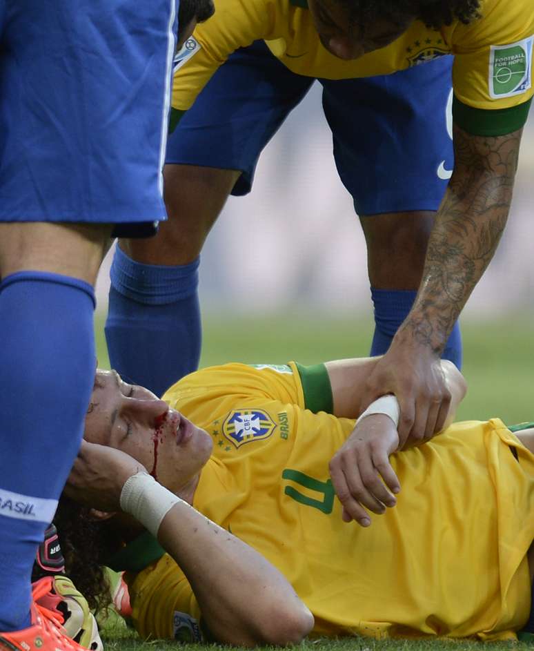 <p>Cena assustadora e rosto assutador de David Luiz causaram impacto em campo</p>