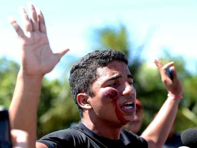 <p>Manifestante é atingido com bala de borracha no rosto durante protesto do lado de fora da Arena Castelão</p>