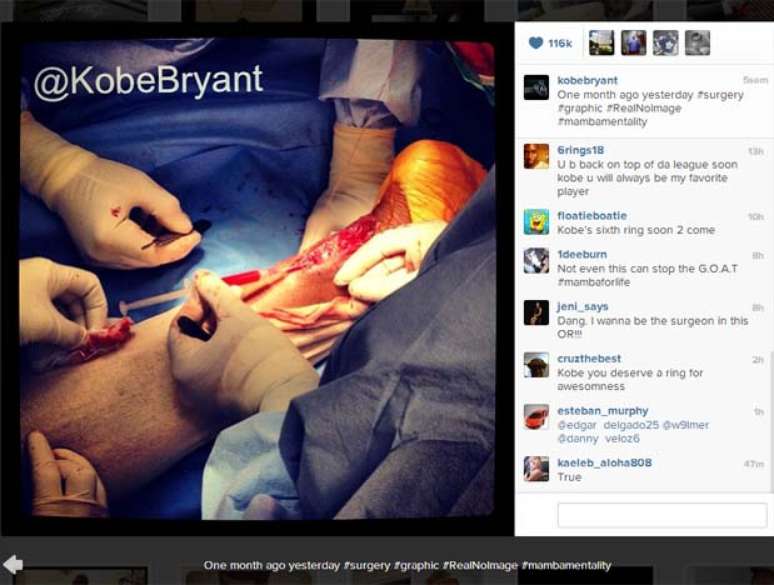 Kobe Bryant postou imagem da cirurgia no Tendão de Aquiles