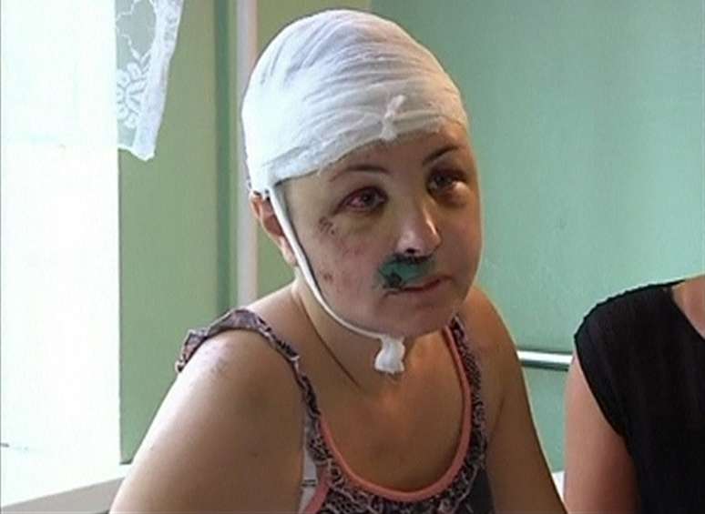Iryna Krashkova, vítima de estupro na Ucrânia: policiais acusados de envolvimento e revolta na vila de Vradiyevka