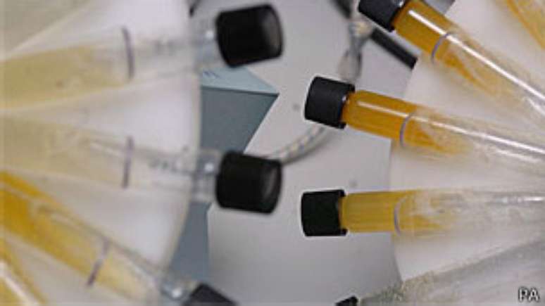 Dispositivo detecta odor de elementos químicos presentes na urina de pessoa com câncer