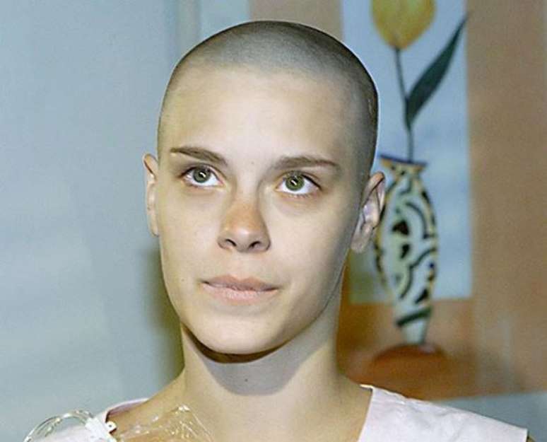 Carolina Dieckmann raspou os cabelos para dar vida à personagem Camila, que sofria de leucemia, em 'Laços de Família' (2000)