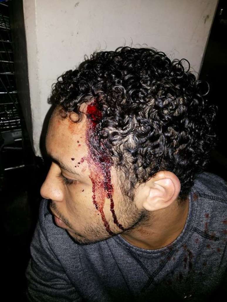 Jovem compartilhou no Facebook foto em que mostra ferimento na cabeça