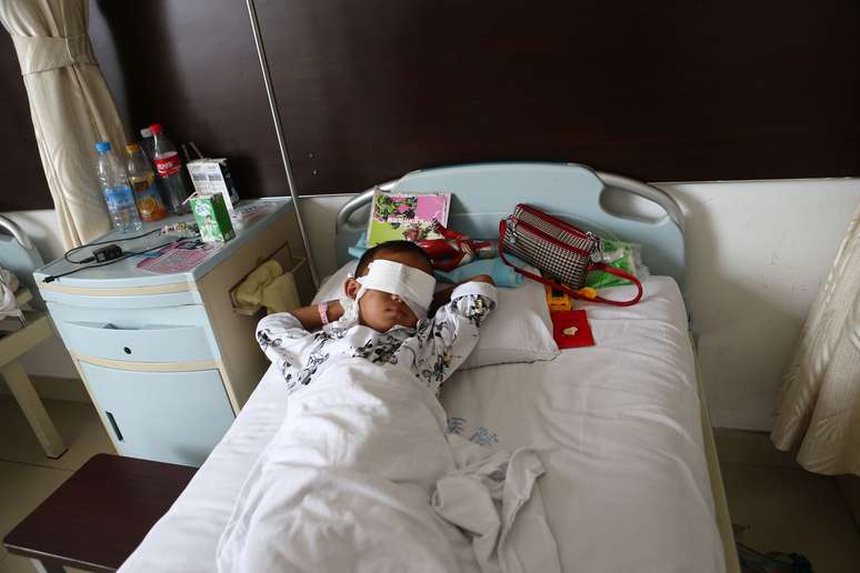O menino, que ficou cego, em sua cama no hospital, com a região dos olhos cobertas por uma faixa