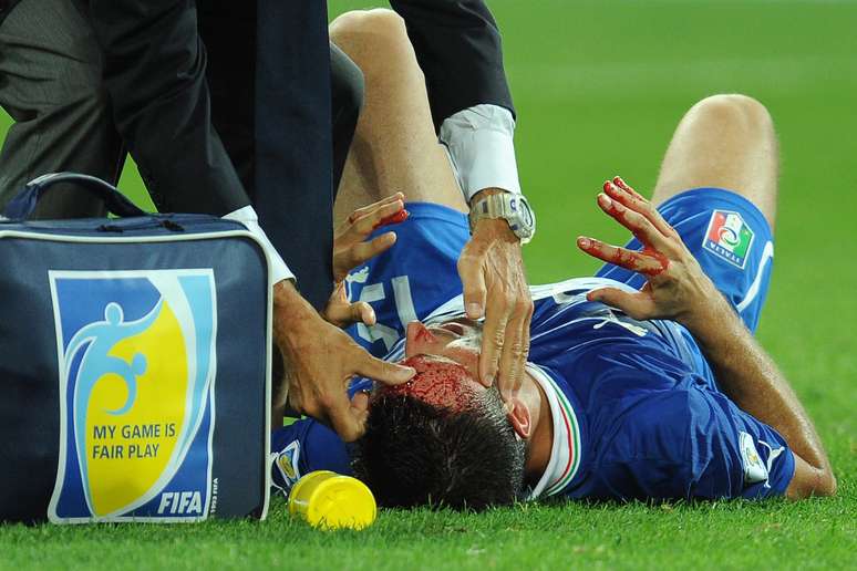<p>Nem tudo foi festa para a Itália na vitória por 2 a 1 sobre a República Checa; o lateral Pasqual se machucou feio após choque e gerou preocupação</p>
