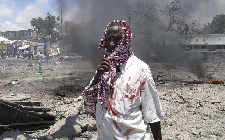 Homem ferido é fotografado após atentado terroristas reivindicado pela Al-Shabab em Mogadíscio, em 4 de outubro de 2011