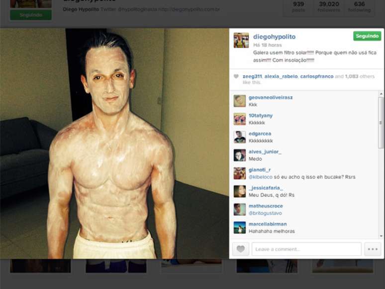 Diego Hyp&oacute;lito postou foto ap&oacute;s insola&ccedil;&atilde;o