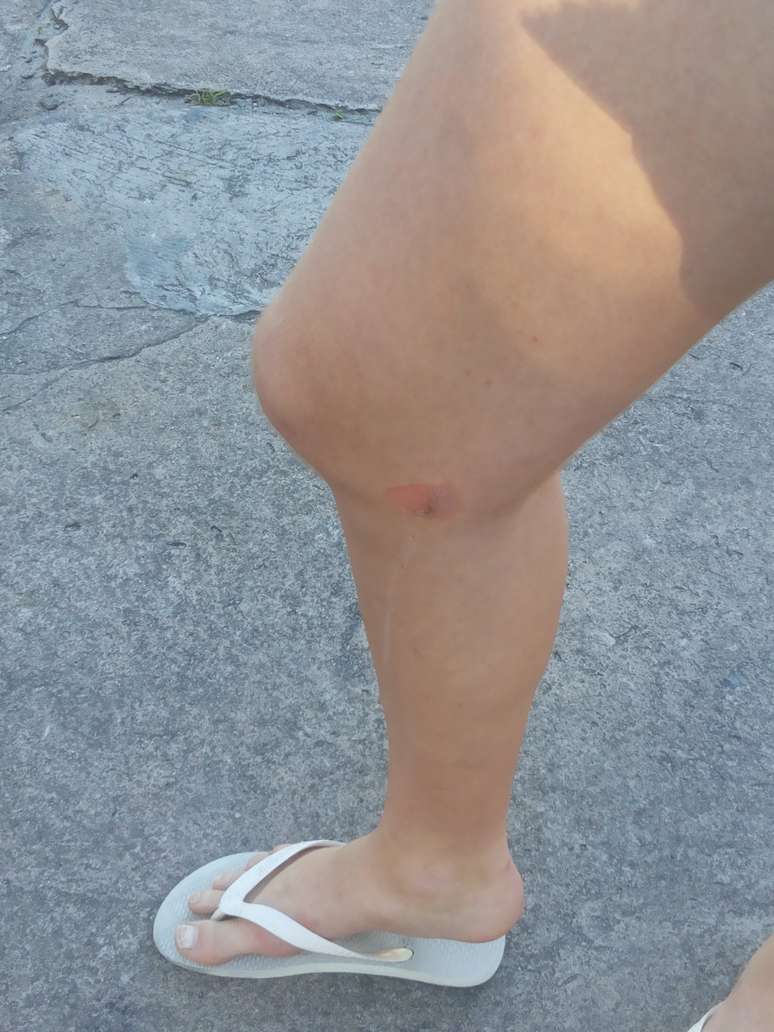 Salvador - A jovem disse que ficou sentido uma 'dor horr&iacute;vel' durante todo o exame