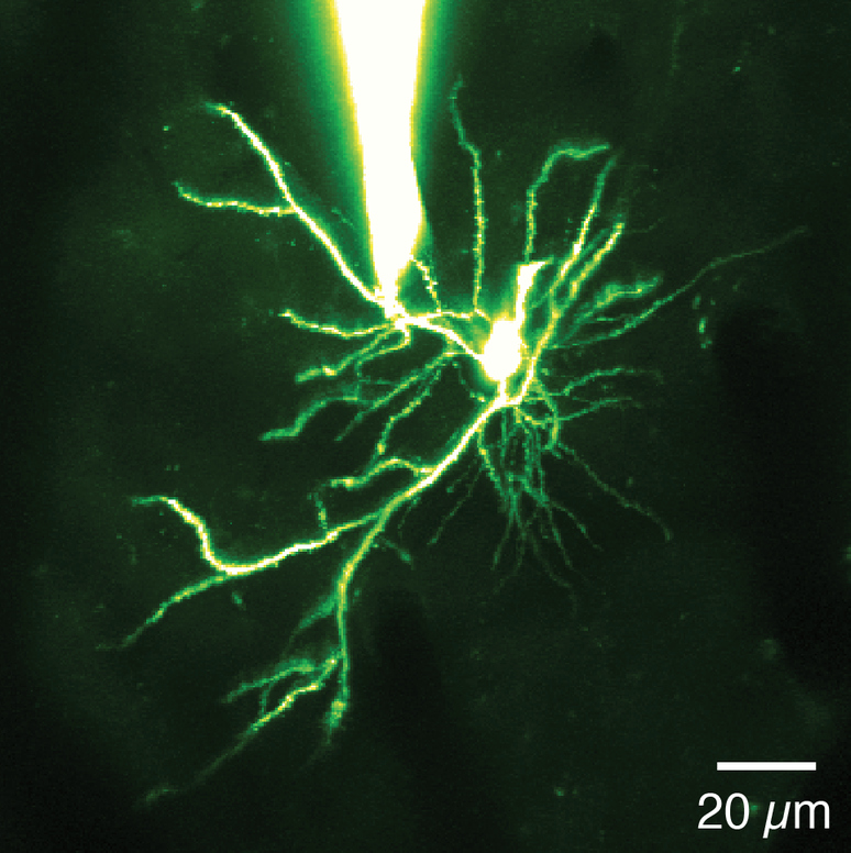 Imagem mostra um dendrito, uma estrutura em forma de galho do neurônio. O objeto no topo é uma pepita presa ao dendrito para medir a eletricidade. O brilho no centro da imagem é um pico de eletricidade que ocorre quando essa estrutura processa informação