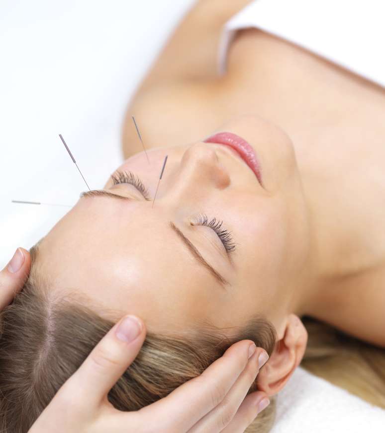 <p>Bem-estar e funcionamento melhor de todo o corpo também são benefícios trazidos pela acupuntura</p>