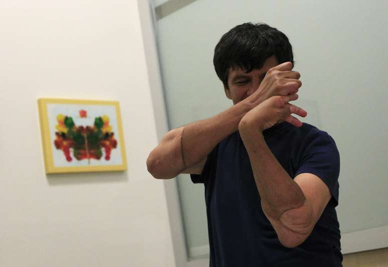 O mexicano Gabriel Granados participa de uma sessão de fisioterapia em um hospital localizado na Cidade do México, após passar por transplante de braços