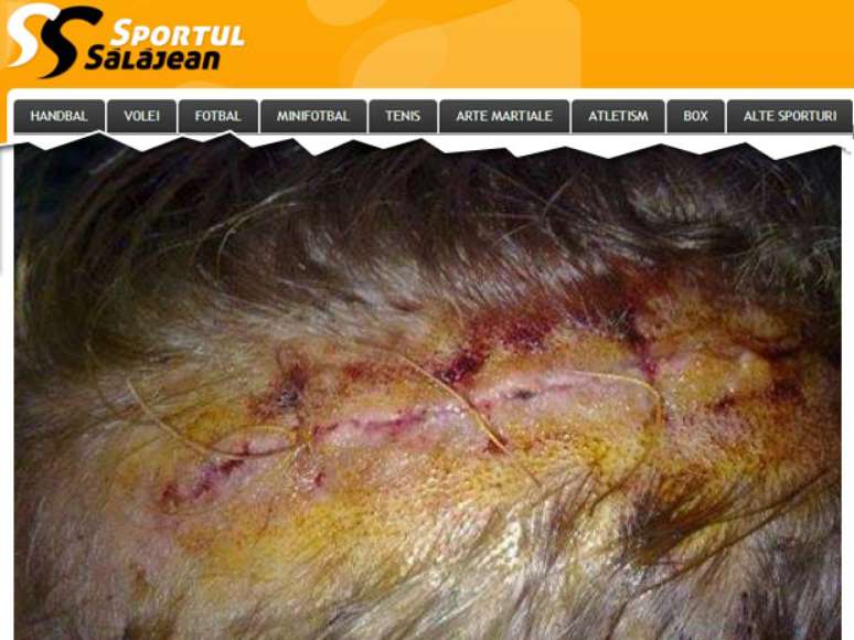 <p>Detalhe do corte provocado pelo golpe em Connor</p>