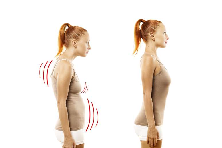 <p>Postura inadequada compromete o uso correto dos músculos aumentando os pneuzinhos e dificultando perder a gordura</p>