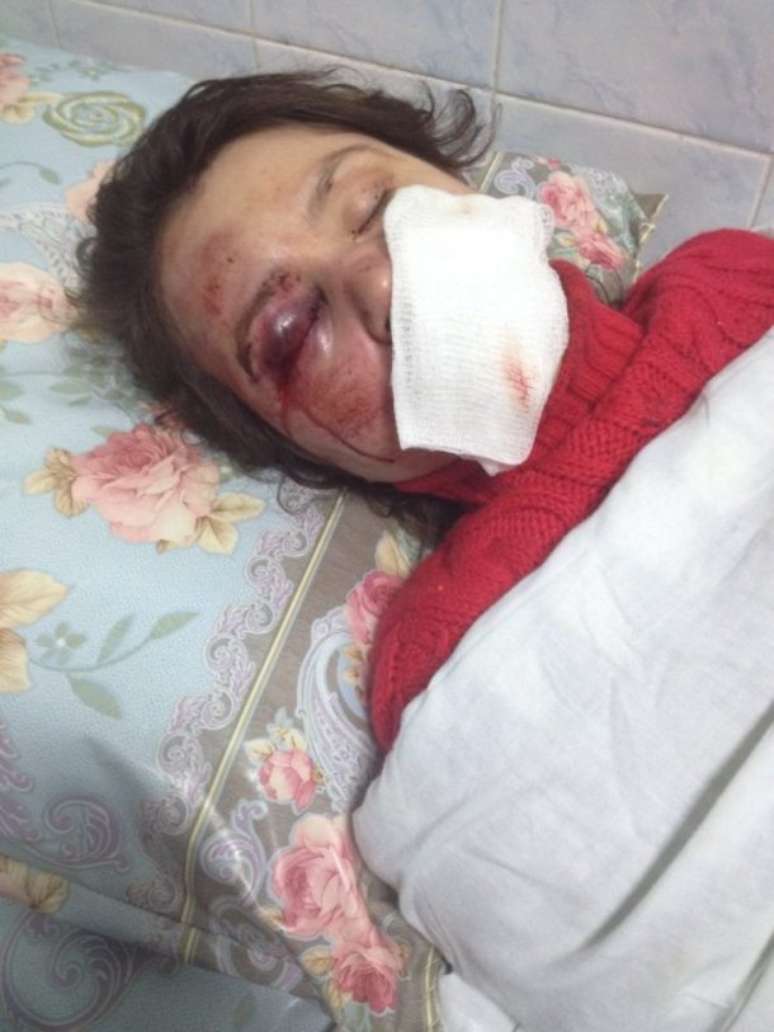 Tetyana aparece deitada no hospital após apanhar